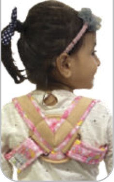 IGR Meek Clavicle Brace (Pediatric)