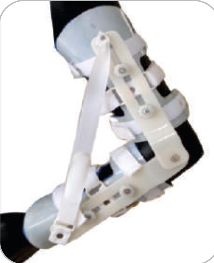IGR Elbow Mobiliser