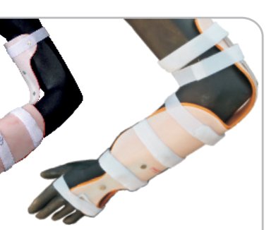 IGR Forearm with Ext. Support