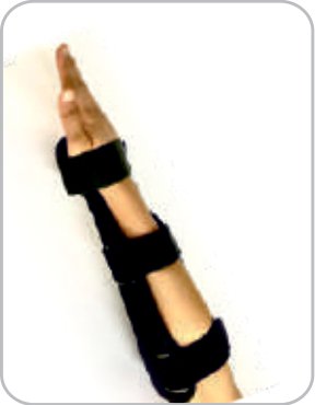 IGR Cock-up Splint Half