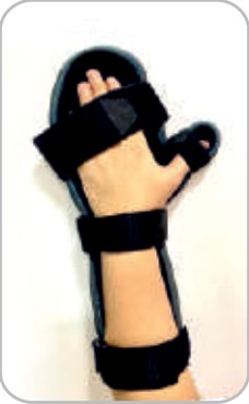 IGR Cock-up Splint Full