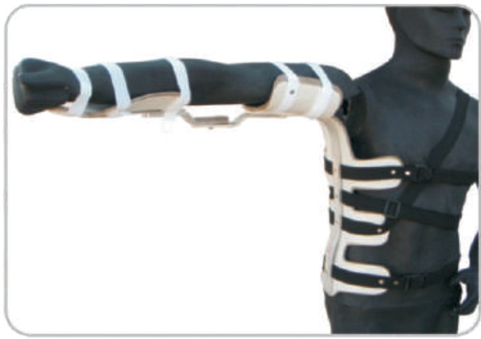 IGR Aeroplane Splint Upto Wrist