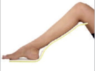 IGR Long Leg Splint
