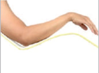 IGR Long Arm Splint
