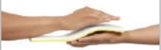 IGR Short Arm Splint
