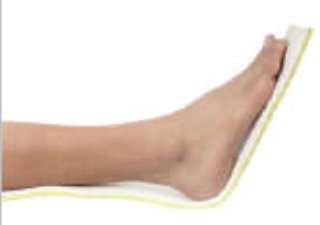 IGR Short Leg Splint